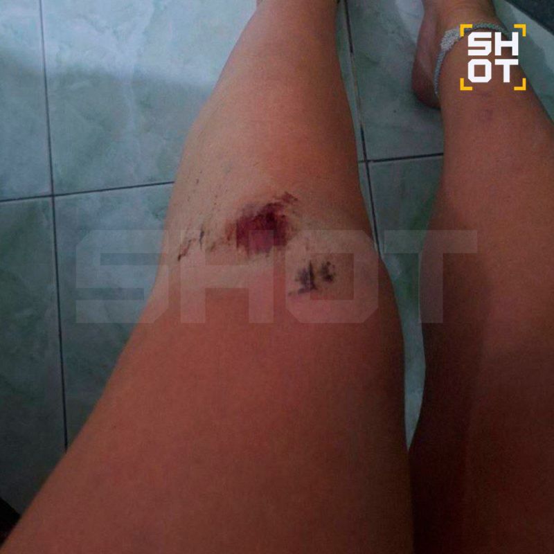 ОПГ с мачете нападает на российских туристов на курортах Кении ОПГ с мачете нападает на российских туристов на курортах Кении