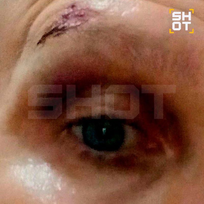 ОПГ с мачете нападает на российских туристов на курортах Кении