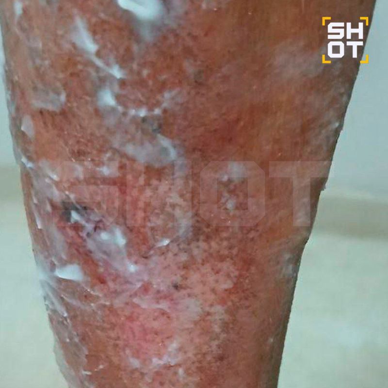 ОПГ с мачете нападает на российских туристов на курортах Кении ОПГ с мачете нападает на российских туристов на курортах Кении